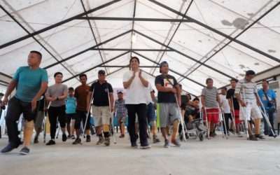 Congressman Guico III distributes 26 free prostheses legs, 1 wheelchair
