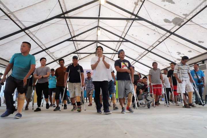 Congressman Guico III distributes 26 free prostheses legs, 1 wheelchair